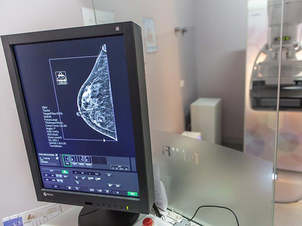 Mamografias Exmaes preventivos câncer mama