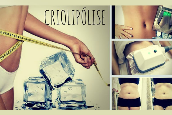 criolipólise criolipólise