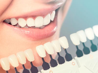 Clareamento dos dentes Clareamento dental
