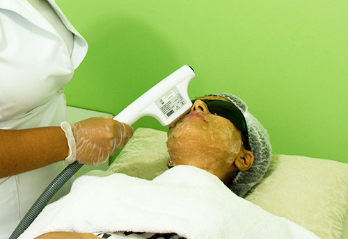 fotorejuvenescimento fotorejuvenescimento