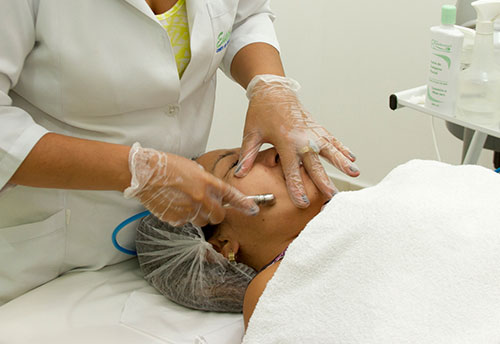 peeling de diamante peeling-diamante