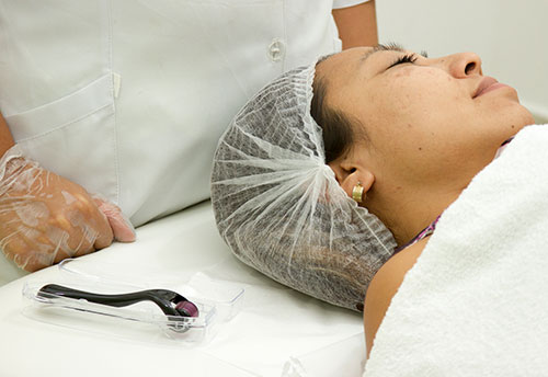 terapia de manchas - microagulhamento terapia-manchas