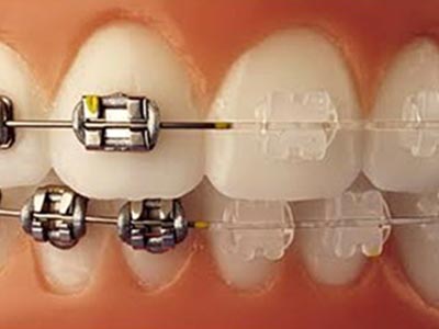 Aparelhos estéticos, fixos e móveis aparelhos-esteticos