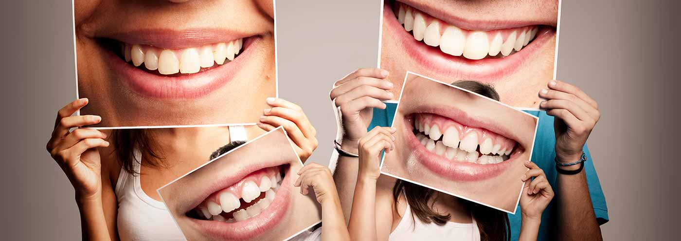 Aparelho Dental, Estética Bucal, Endodontia, Extração de dente, Clareamento, Prótese e mais Aparelho Dental, Estética Bucal, Endodontia, Extração de dente, Clareamento, Prótese e mais