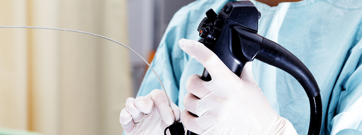endoscopia e colonoscpia endoscopia e colonoscpia
