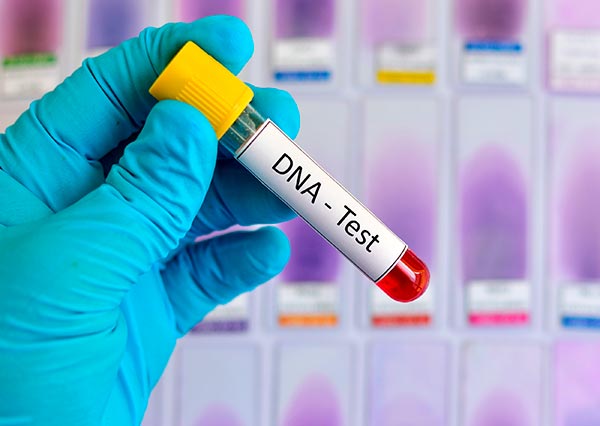 Teste de paternidade teste de paternidade