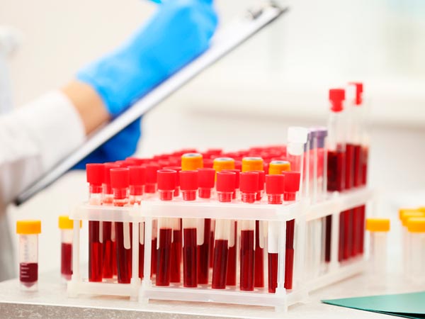 Exames de sangue Hemogramas