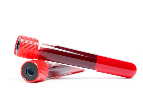 Testes de sangue Exames de sangue
