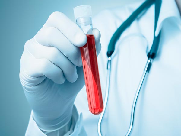 Exames toxicológicos Exames toxicológicos