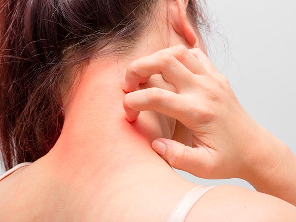 Tratamento de dermatites Tratamento de infecções de pele e dermatites