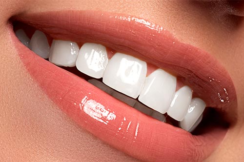 lentes de contato dental lentes-de-contato-dental
