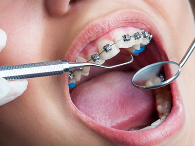 Tratamento ortodôntico Tratamento ortodôntico