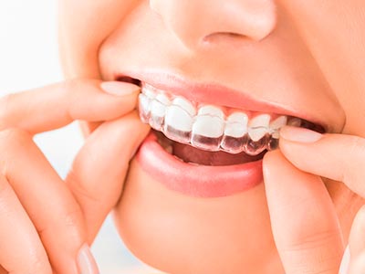 Ortodontia e estética dental Estética dental
