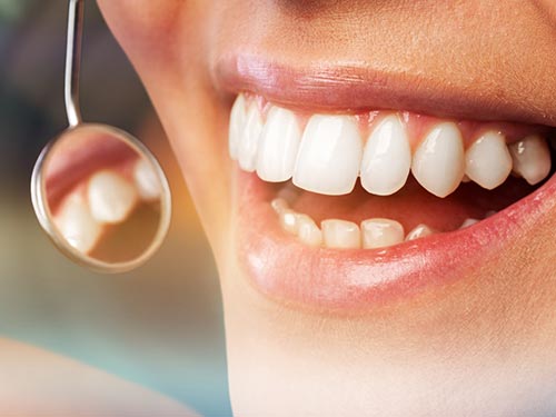 Tratamento de problemas da região da gengiva Periodontia