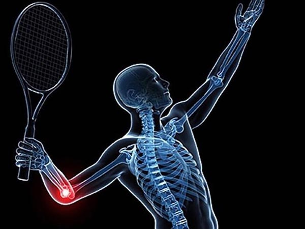 Lesões em praticantes de esportes Traumatologia esportiva