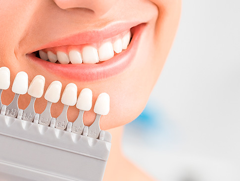 Tratamento utilizado para tornar os dentes mais brancos Clareamento dental