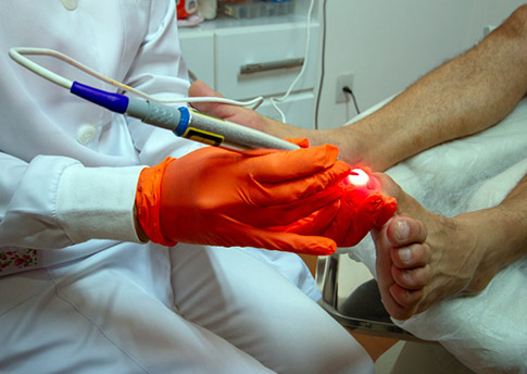 tratamento com laser terapia tratamento com laser terapia