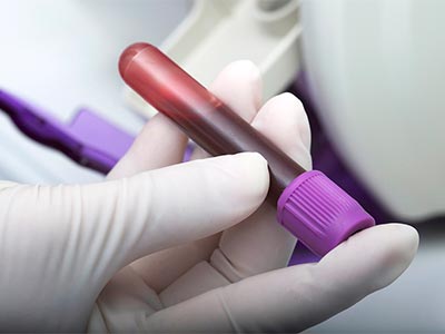 Realizamos exames laboratoriais Amostra de sangue