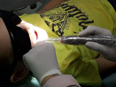 Laser Terapia Laser Terapia