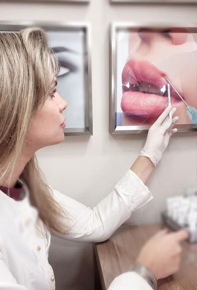 Preenchimento Labial Preenchimento Labial
