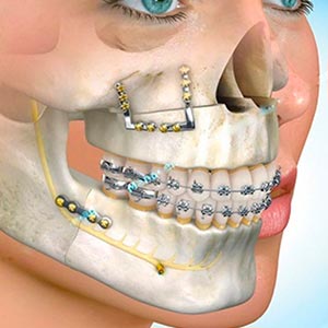 Cirurgia bucal Cirurgia bucal