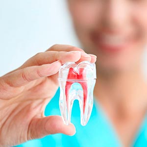 Endodontia (tratamento de canal) Endodontia (tratamento de canal)