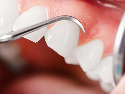 Periodontia Periodontia