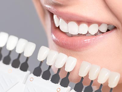 Técnica que deixa os dentes mais brancos Clareamento dental