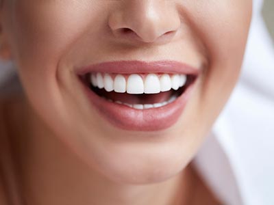 Procedimentos para melhorar ou recuperar a estética do sorriso Estética bucal