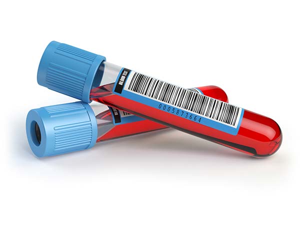 Exame de sangue Amostra de sangue