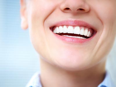 Procedimento que visa a correção da exposição excessiva das gengiva superior ao falar ou sorrir Correção do sorriso gengival