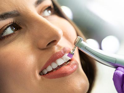 Procedimento eficaz para remover o tártaro que se instala entre a gengiva e os dentes Limpeza e raspagem dos dentes