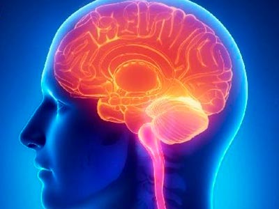 Meningite Dengue