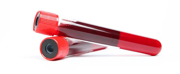 Coleta domiciliar de material para exames Amostras de sangue
