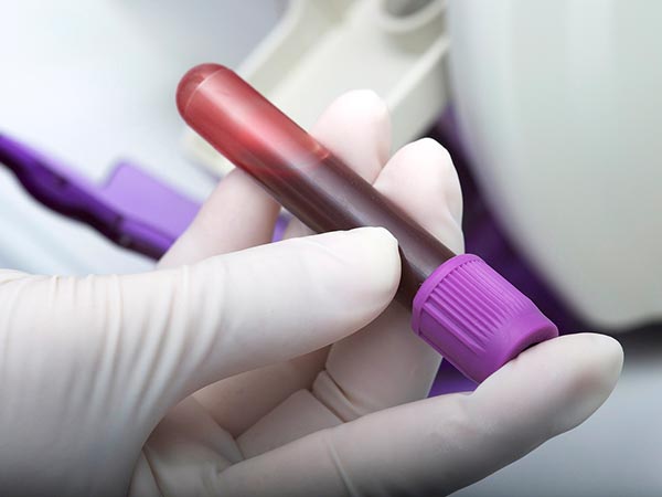 Exames de sangue Amostra de sangue