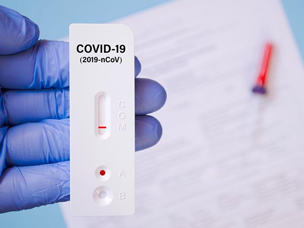 Teste que detecta o antígeno SARS-CoV 2 com resultado no mesmo dia Teste rápido para o Covid-19