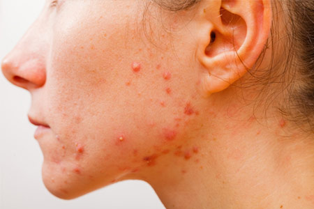 tratamentos de doença faciais e corporais tratamentos de doença faciais e corporais