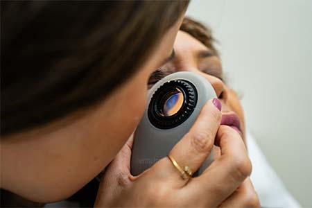 dermatoscopia dermatoscopia