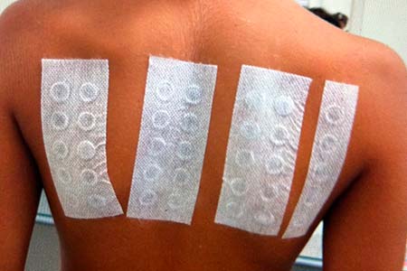 patch teste patch teste