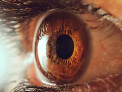 Retina e vítreo Retina e vítreo