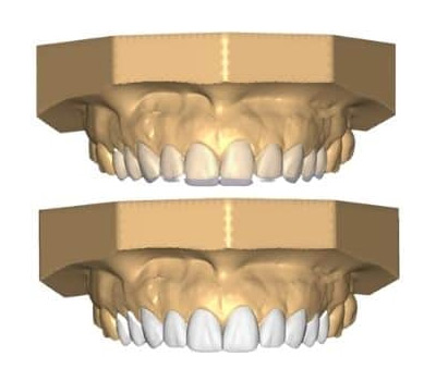 prototipagem prototipagem