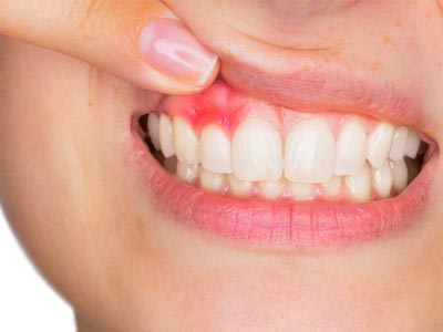 periodontia periodontia