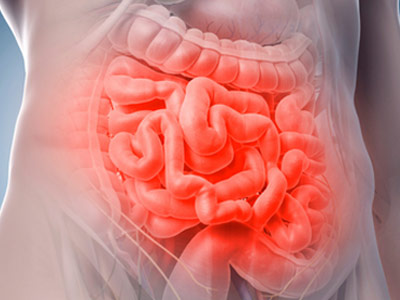 síndrome do intestino irritável síndrome do intestino irritável
