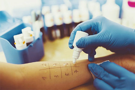 prick test prick test