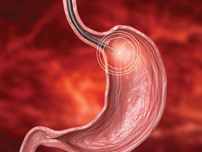Endoscopia Endoscopia