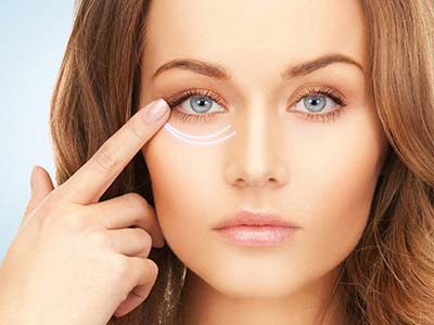 Blefaroplastia Blefaroplastia