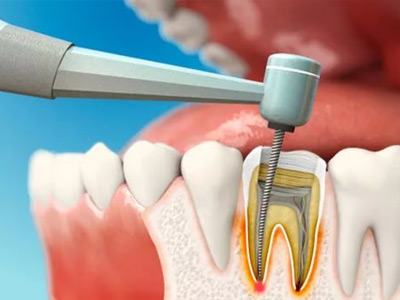 Endodontia