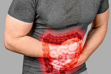 Tratamento para Doença de Crohn e retocolite ulcerativa Doença de Crohn e retocolite ulcerativa