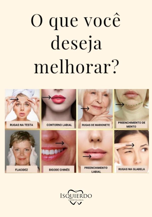 o que deseja melhorar o que deseja melhorar