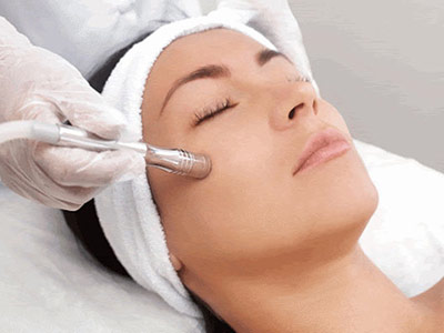 peeling facial peeling facial